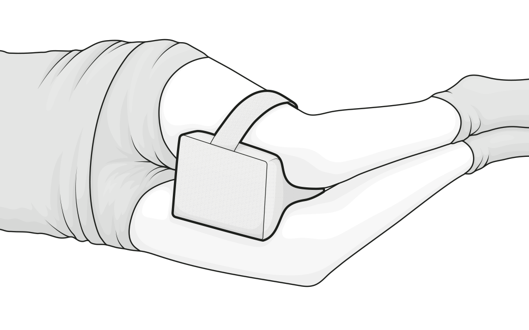 Illustration: A person in the lateral position has the knee cushion clamped between the thighs.	