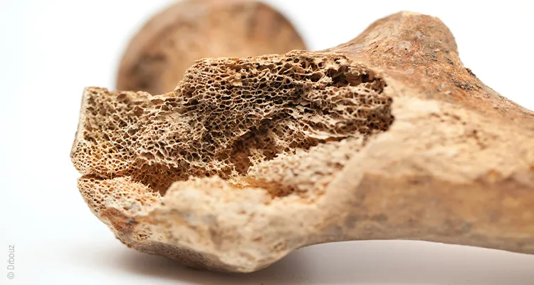 Close-up of a splintered bone, showing the porous structure. 